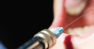 Dental anaesthetics | Thai Dental News | Dental Resource Asia