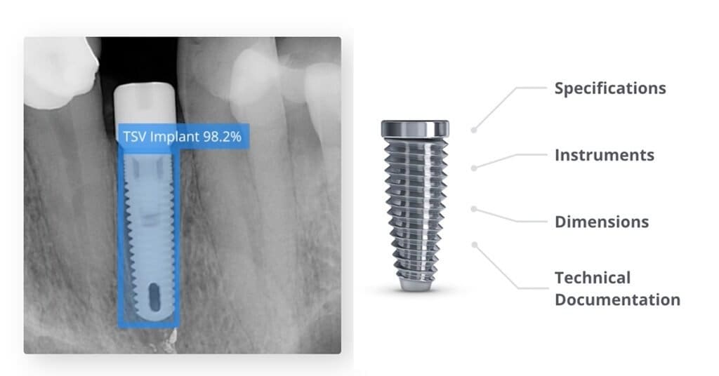 Spotimplant | IoT Dental | Dental Resource Asia
