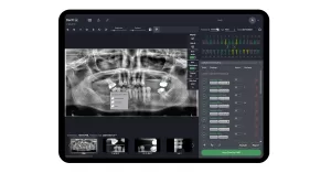 FDA clears AI-powered Denti.AI Auto-Chart_Dental Resource Asia