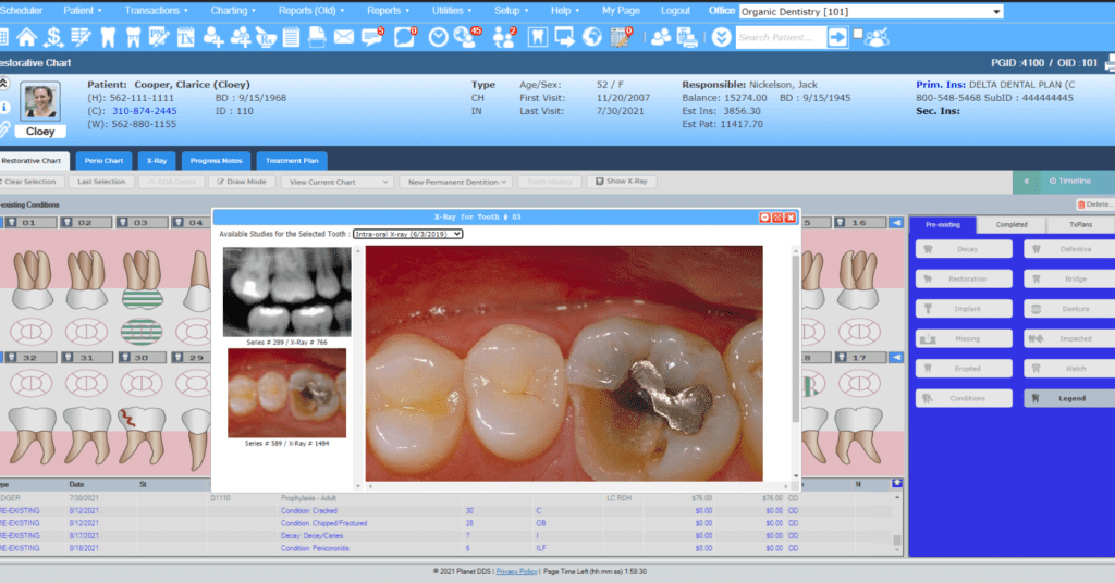 Choosing the right dental PMS_Denticon Digital Chart_Dental Resource Asia