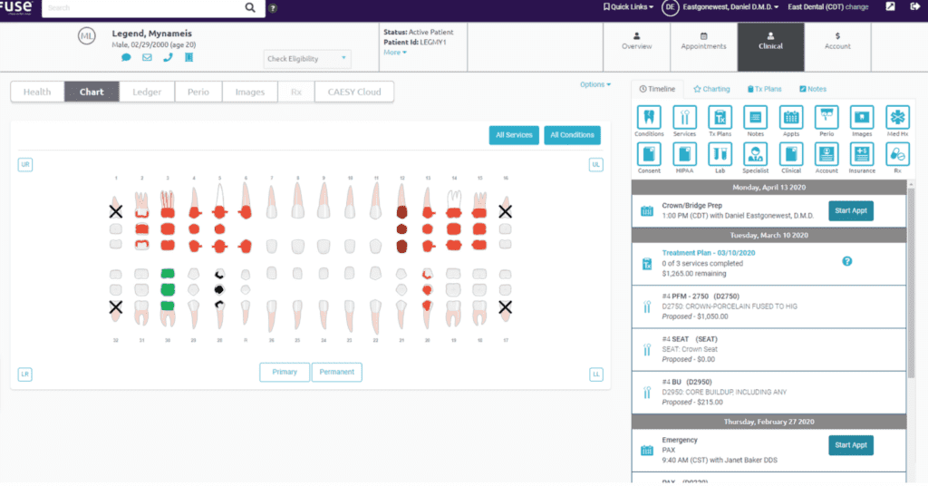 Choosing the right dental PMS_Fuse Dental Chart_Dental Resource Asia