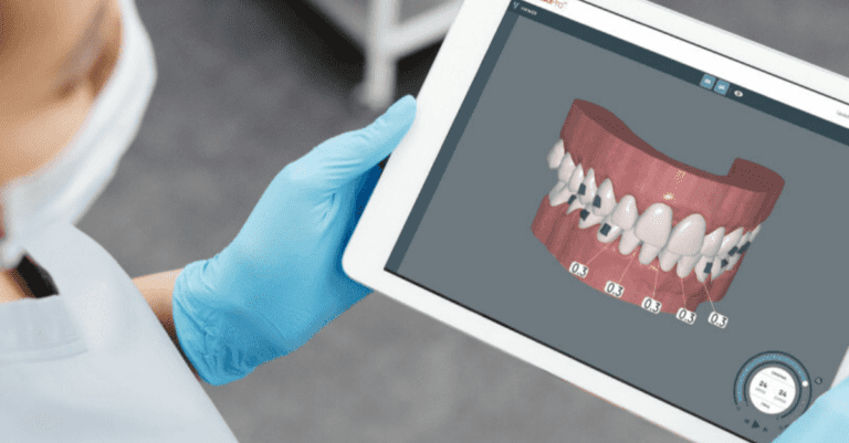 CandidPro Empowers Clear Aligner Doctors with Enhanced Clinical Features_Dental Resource Asia