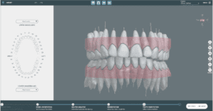 SoftSmile’s VISION Treatment Planning Software Integrates CBCT Imaging_dental Resource Asia