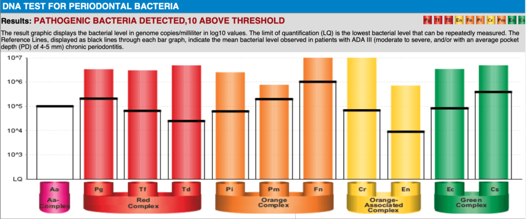 Fig. 1: DNA PCR test for periodontal bacteria