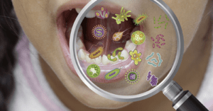 Exploring the Oral Microbiome Unraveling Links to Systemic Diseases_Dental Resource Asia