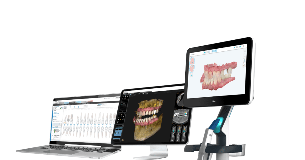 Carestream Dental's Equipment and Software Brands Now Integrate with iTero™ Intraoral Scanners_Dental Resource Asia_1