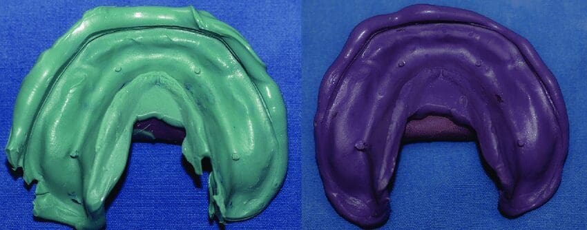 Impressions of polyether and vinyl polyether siloxane